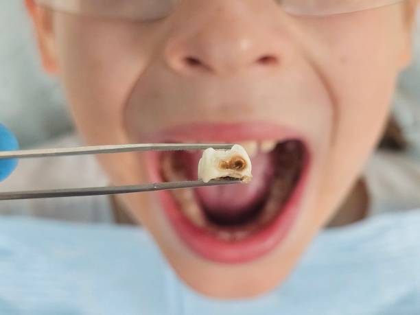 Best Pediatric Emergency Dentist in Hastings, NE
